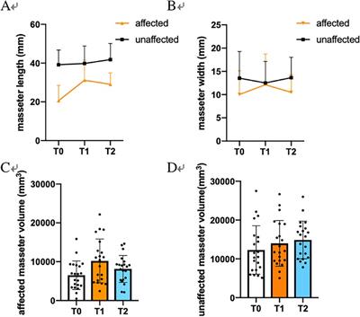 Changes of masseter muscle after mandible distraction osteogenesis in patients with Hemifacial microsomia: a retrospective study